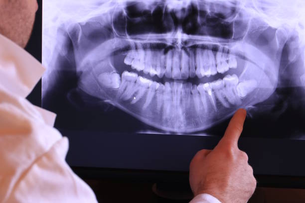 Best Emergency TMJ Treatment in Somerton, AZ