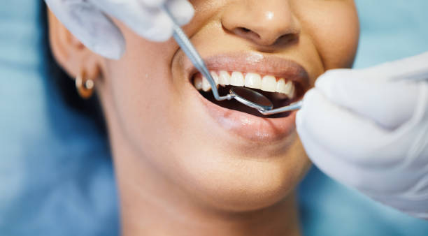 Best Emergency Treatment for Dental Infections or Abscesses in Somerton, AZ